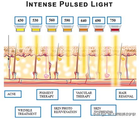 paa美容抗衰和光子嫩肤哪个好,美容光子嫩肤有什么作用
