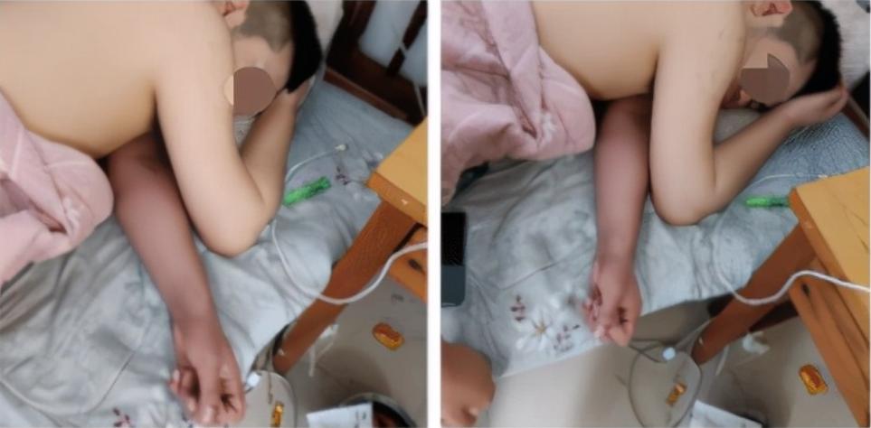 “兄弟睡觉压得胳膊都变色了，要不要叫醒他？”醒来一定很酸爽