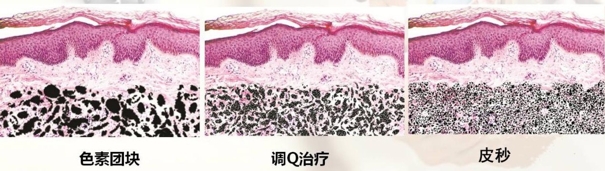 脸上有斑用什么护肤品祛斑效果好,40岁女人脸上长斑怎样有效祛斑