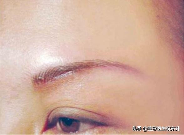 妈妈想做眉毛,妈妈急需做手术