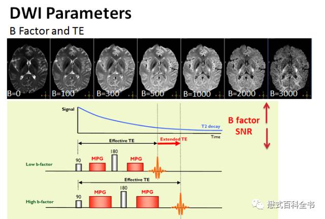dwi成像序列,dwi序列和edwi序列