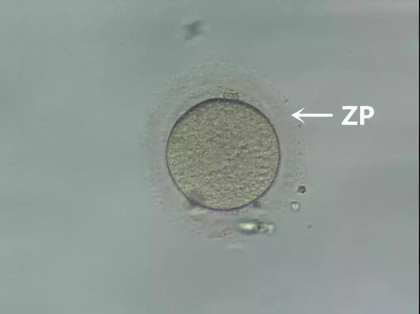 这件“外套”，人人都有过！