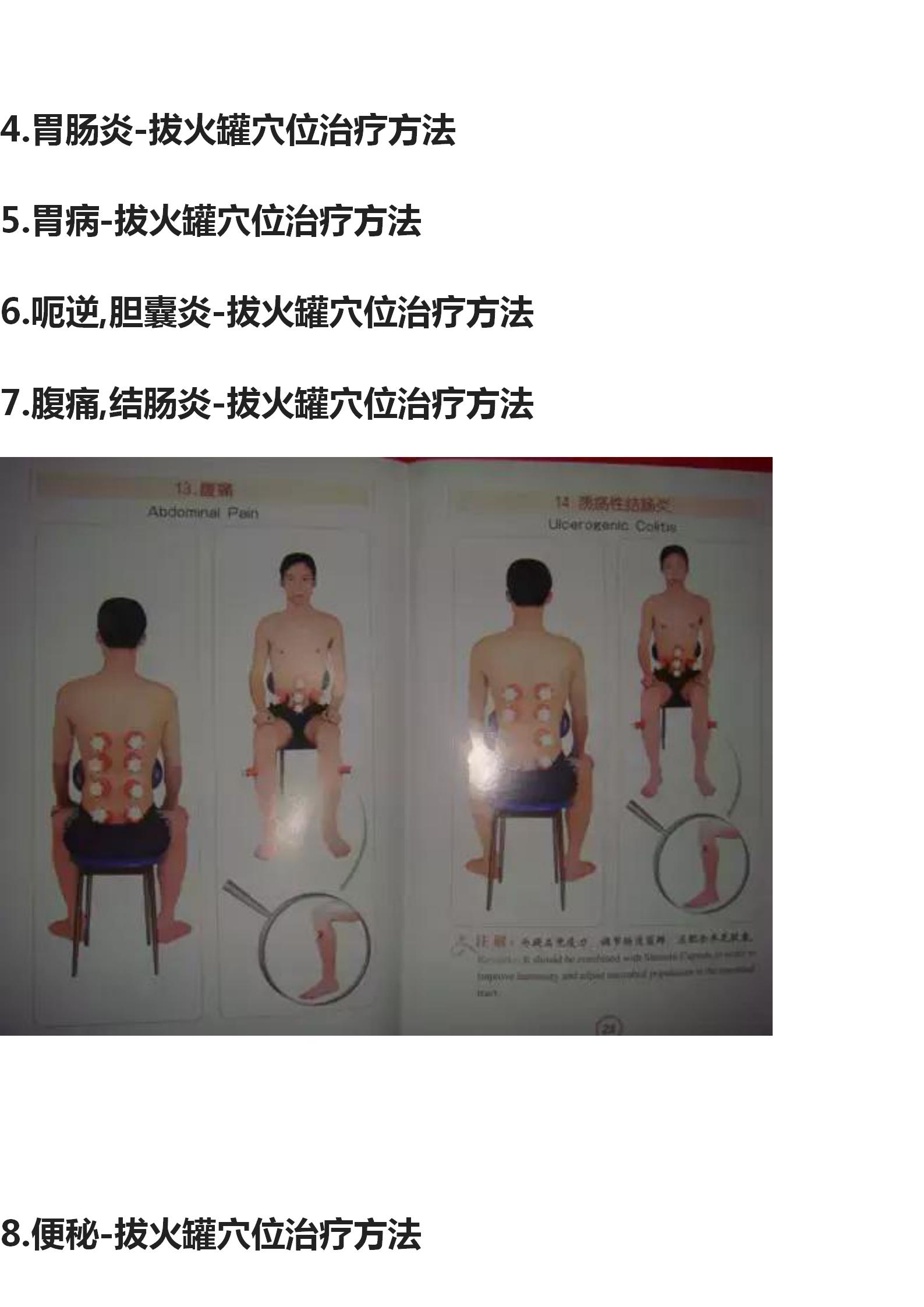 拔罐的手法和穴位图,中医拔罐穴位图片及作用