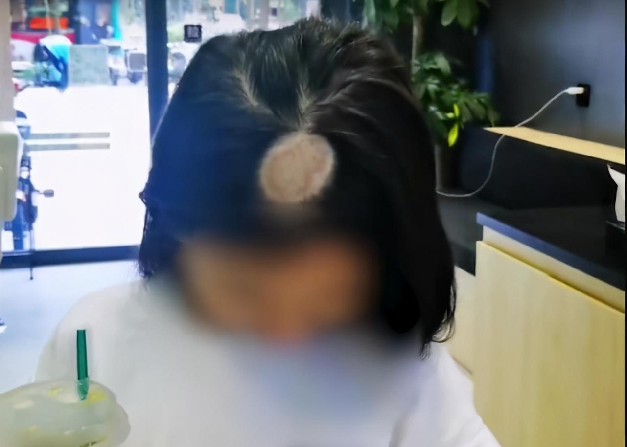 养猫孩子长猫癣什么原因,人得了猫癣怎么养猫