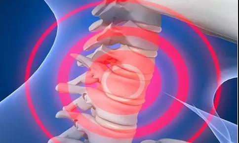 左手手指发麻是脑梗预兆,中风手指发麻预示三种预兆