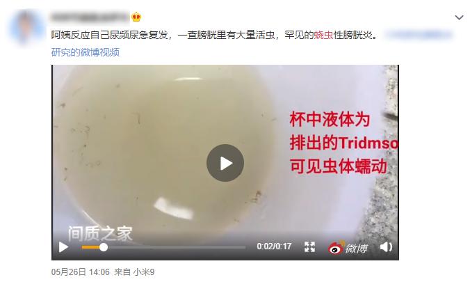 屁屁老是痒痒痒痒痒痒痒痒?蛲虫病了解一下