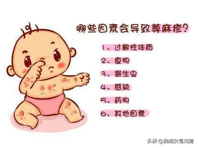 春天花粉过敏脸上起疙瘩,花粉过敏起疙瘩涂什么药