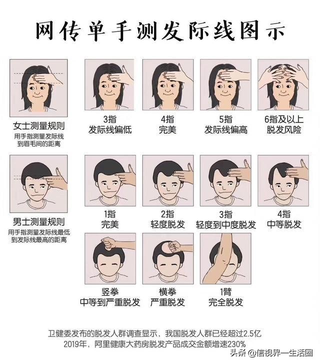 发际线过高或过低的人,发际线太低调整视频