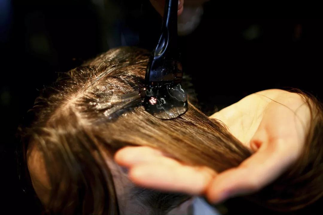 治疗秃头发的偏方有哪些,秃头吃什么偏方有效果