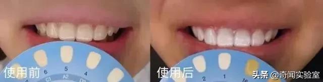 专治牙黄口臭的小窍门,牙黄口臭用什么牌子牙膏刷牙最好