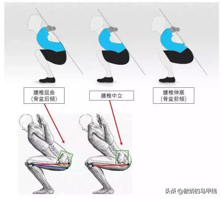 深蹲屁股眨眼如何改善,深蹲屁股眨眼正确吗
