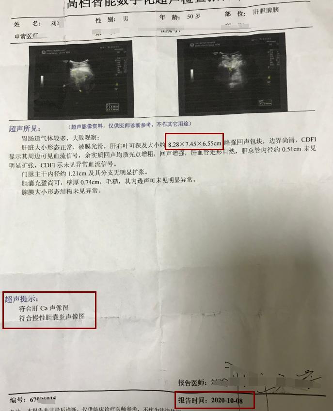 中西结合治疗肝癌效果如何,肝癌肿瘤破裂出血怎么治疗