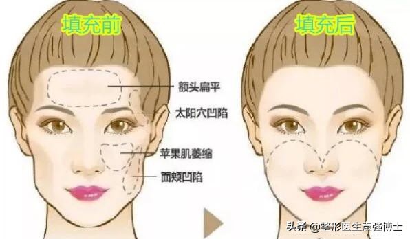 50岁抗褶皱紧致精华,50岁用什么抗衰紧致面霜