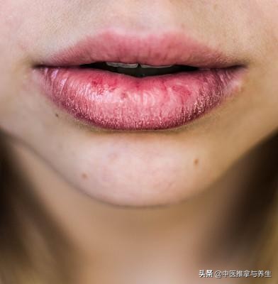 扎手针灸不良反应持续多久,拔罐针灸有不良反应吗