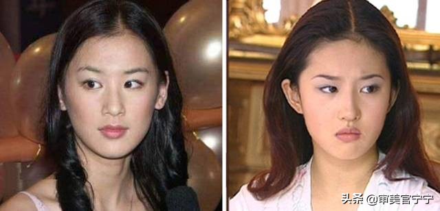 鼻子宽大眼距过近,鼻子宽度大于眼间距原因