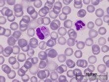 对于犬瘟热，铲屎官你需要知道这些！