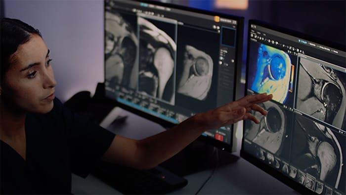 一分钟操作！飞利浦推出新一代无氦AI磁共振