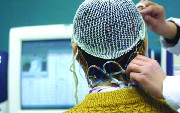 什么是癫痫症状,什么是癫痫治愈的标准