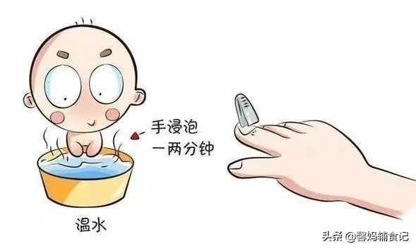 宝宝手上有倒刺应该怎么解决,宝宝手上长倒刺用什么药