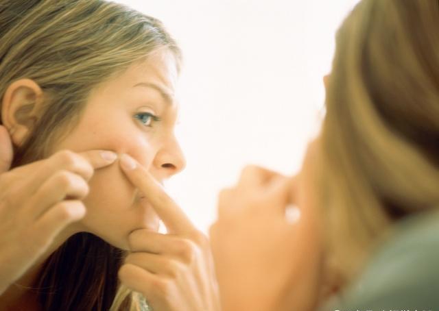 痘痘怎么挤才是正确的视频,痘痘怎么挤闭口