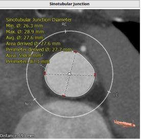 罗建方医生怎么样,罗建方教授