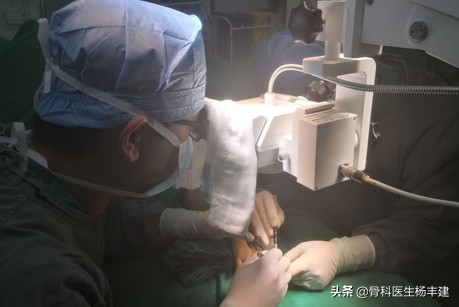 骨折手术后需要注意，什么情况下容易出现钢板断裂？