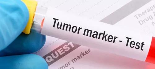 体检查出肺结节莫慌中医有妙招,体检查出肺结节别慌