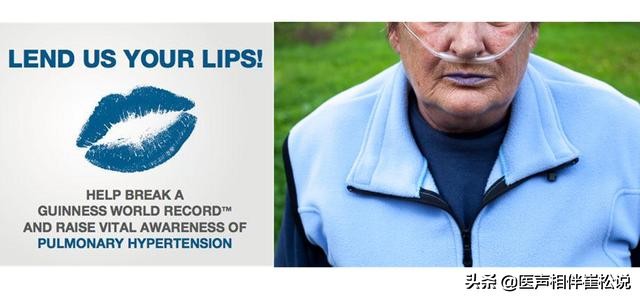 伟哥可以治哪种心脏病,治疗心脏的药伟哥