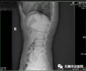 石狮市骨科医院,石狮市总医院骨科多少钱