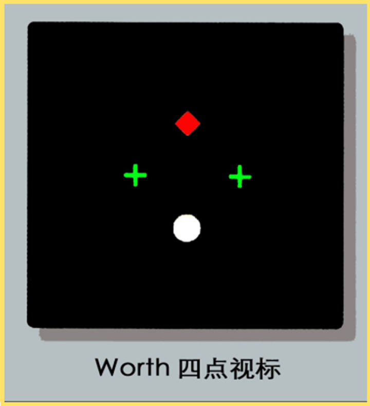 近视的医疗干预措施有哪四种,近视500度可以拯救吗