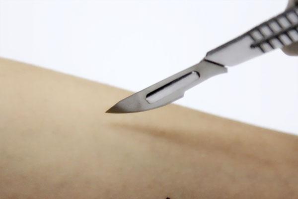 手术后没有放屁就吃饭了怎么办,手术后不放屁直接吃饭会怎样