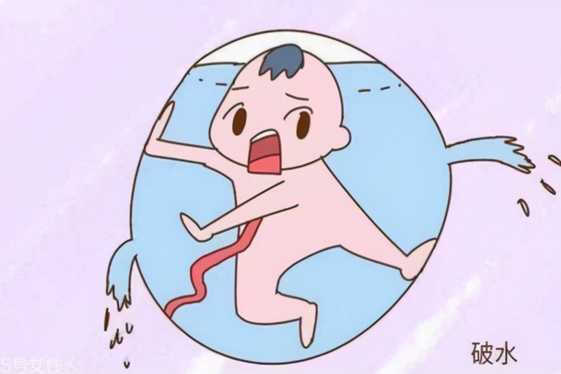 孕妇破水怎么办最有效的方法,孕妇破水了如何处理