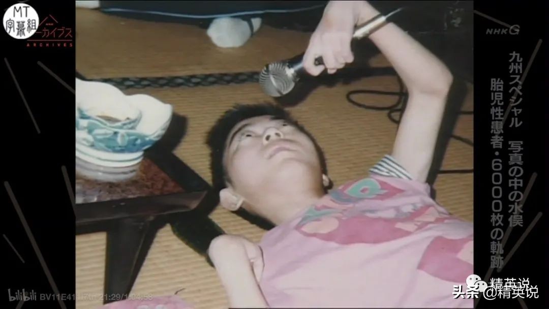 60多年前日本万人中毒成世界公害！如今福岛百万吨核废水入海…