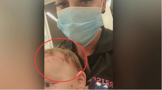 澳大利亚鼠灾真实事件原因,澳大利亚鼠灾最多有多少老鼠