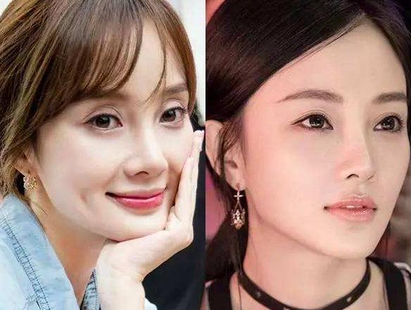 为啥三甲医院做的双眼皮更美,南华博士含金量