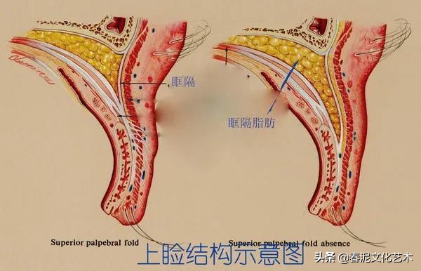 怎么清除美瞳戴过的组织,去除美瞳线的方法
