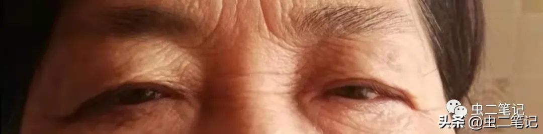 白虎汤加人参配方和量,人参白虎汤的名中医运用经验