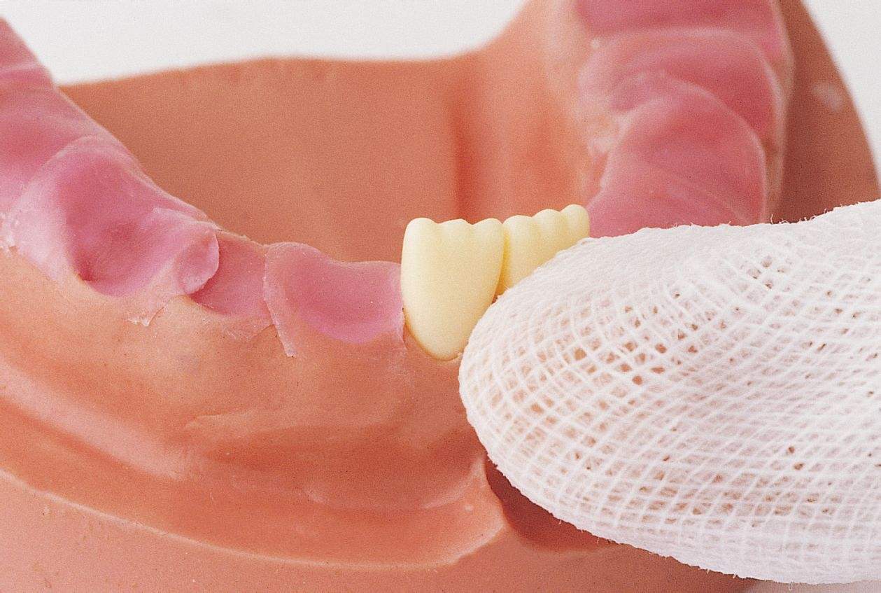 3岁宝宝牙齿蛀牙怎么办,3周岁宝宝蛀牙怎么让他配合