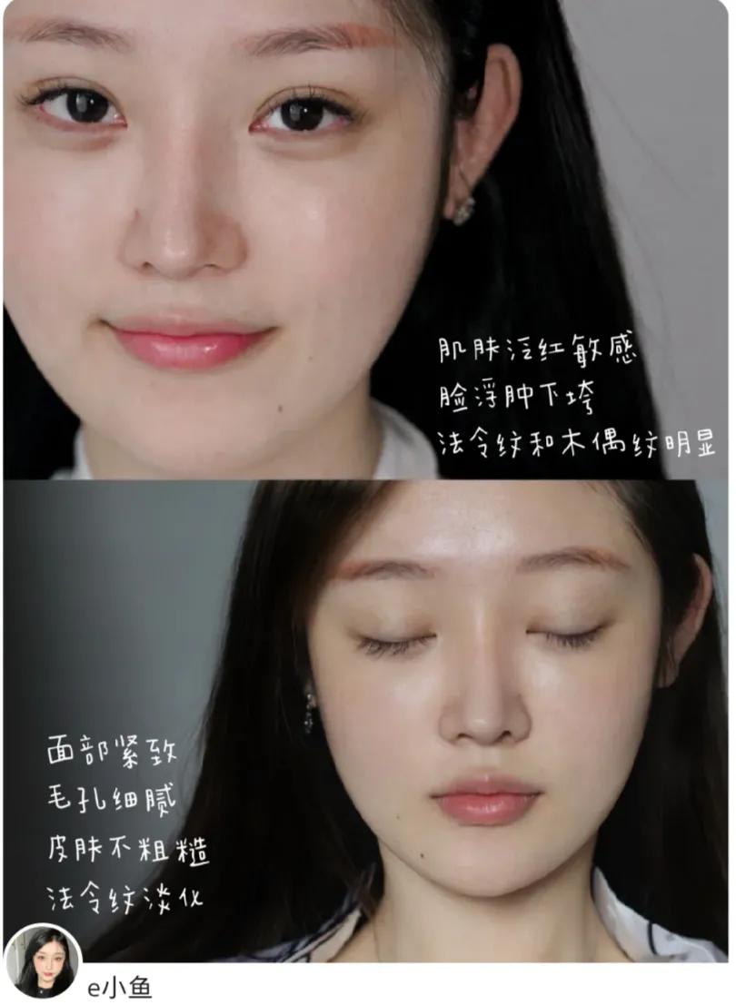 雅顿金胶和粉胶有什么区别,雅顿啵啵胶和粉胶能一起用吗