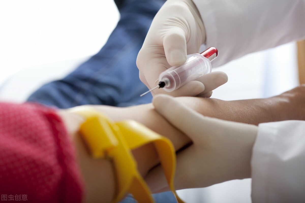 采血后鼓包有淤青有影响吗,抽血后淤青鼓包硬硬的疼痛