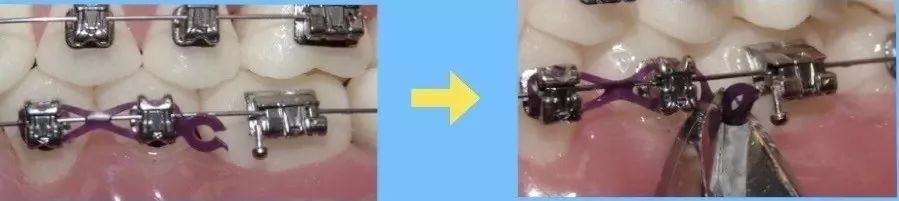 非常时期保护自己避开毒,非常时期是危机还是转机