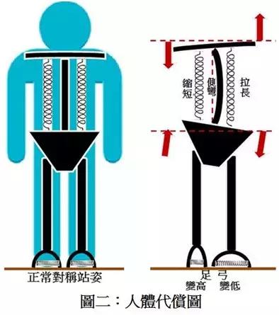 长短脚怎么通过站姿矫正,儿童长短脚矫正锻炼方法