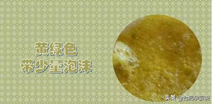 小宝宝拉绿屎怎么了,老话说宝宝拉绿屎怎么说