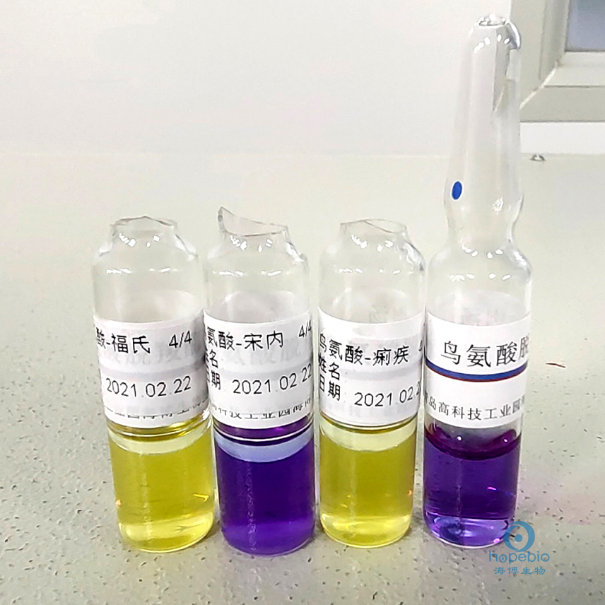 食品中志贺氏菌的检测,志贺氏菌检测标准值是不得检出吗