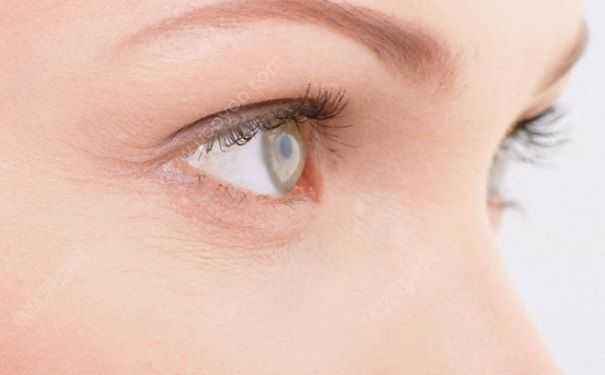 眼尾纹去皱纹效果好吗,有眼尾纹怎么办