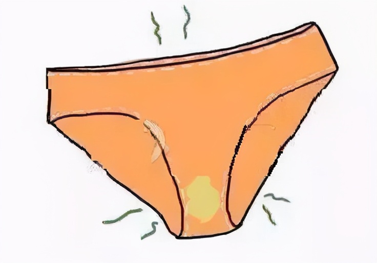 细菌性阴道炎的“克星”,经常吃远离妇科疾病