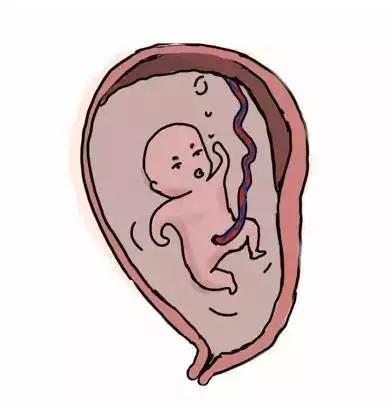 胎盘早剥真实案例,产房故事的视频