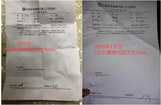 腰突导致肌肉萎缩怎么锻炼比较快,锻炼过度导致腰肌劳损