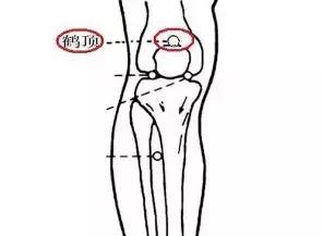老寒腿症状年轻人怎么预防,预防膝盖老寒腿的方法