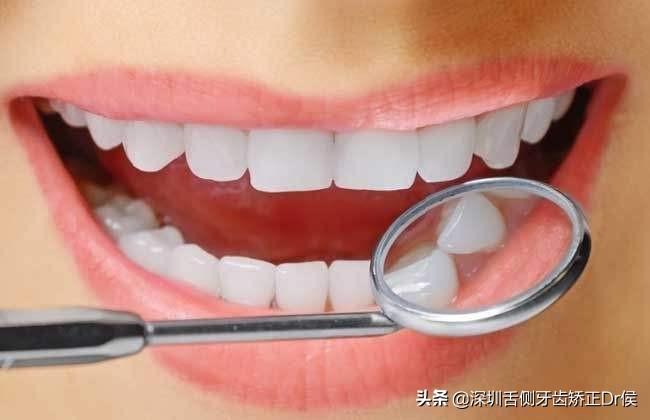 保持器怎么做微调,保持器该怎么选